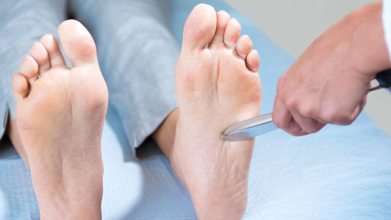Foto - Yazın görmezden gelinen tehlike! Diyabet hastalarında ayak kaybına götüren risk