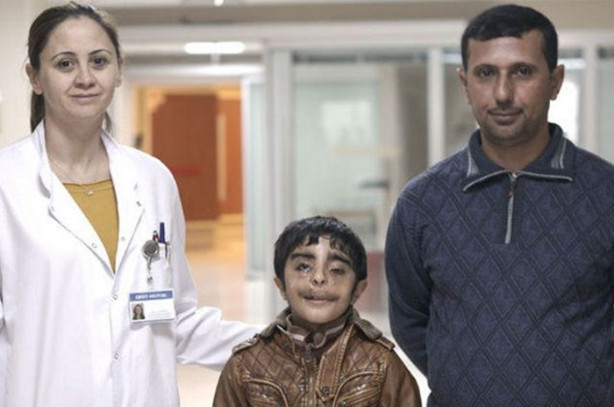 Foto - Yediği her şey gözünden çıkıyor!