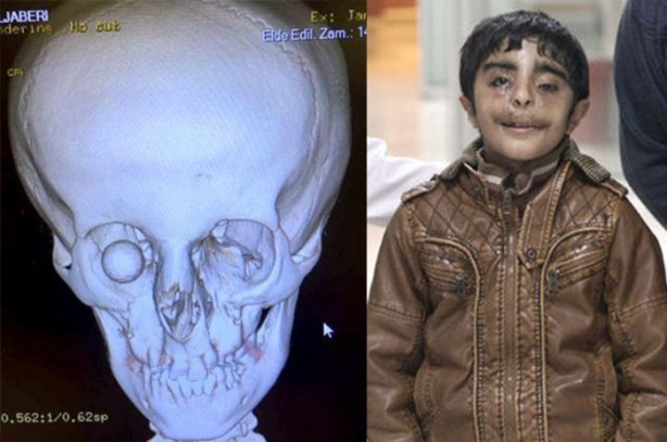 Foto - Yediği her şey gözünden çıkıyor!