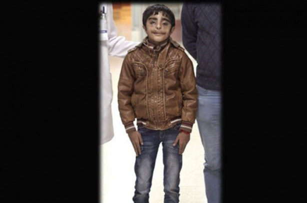 Foto - Yediği her şey gözünden çıkıyor!