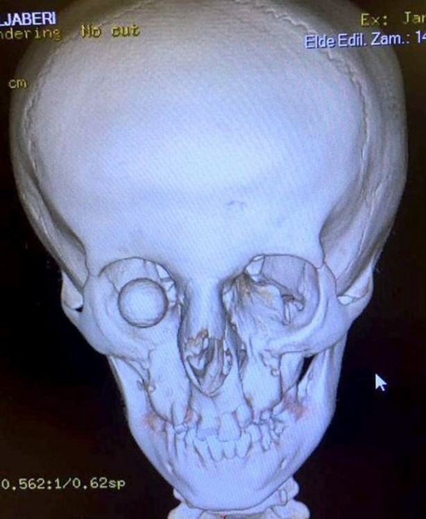 Yediği her şey gözünden çıkıyor!