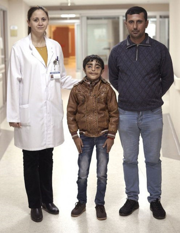 Foto - Yediği her şey gözünden çıkıyor!