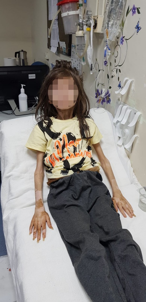 Foto - Yeğenini çöp evde alıkoyan vicdansız teyze hakkında yeni gelişme!