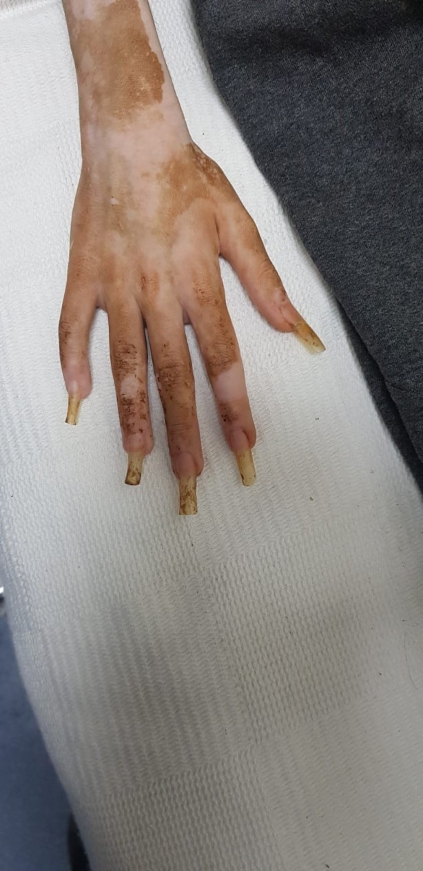 Foto - Yeğenini çöp evde alıkoyan vicdansız teyze hakkında yeni gelişme!