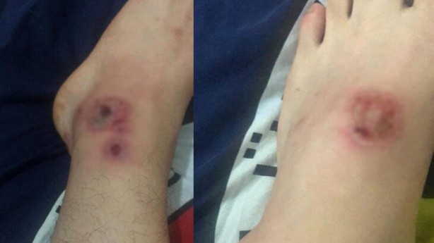 Foto - Yemeğinize sivrisinek konarsa hemen bırakın! Yoksa...