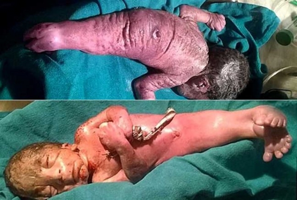 Foto - Yeni doğmuş bebeği görenler hayrete düştü!