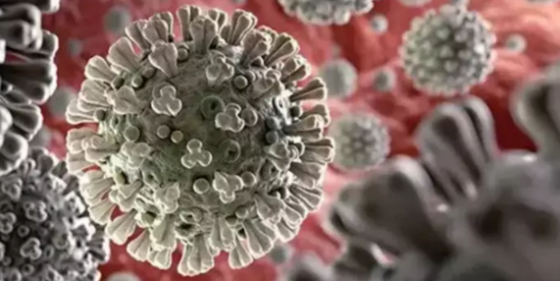 Foto - Yeni kabus: Alaskapox virüsü! Yetkililer ilk ölümün gerçekleştiğini duyurdu!