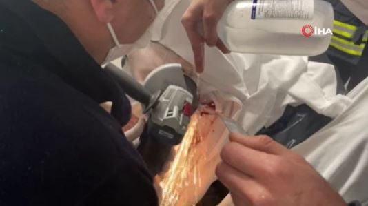 Foto - Yere düşen işçinin sırtına testere saplandı!