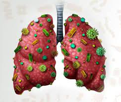 Foto - Yeşilliklerin kralı: Tere otu kürü! Korumalı karışımı var! Herkes parasını cebine koysun! Besin değeri çok yüksek sebze