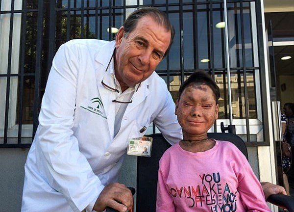 Foto - 'Yılan Kız'ın son hali şaşırttı