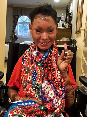 Foto - 'Yılan Kız'ın son hali şaşırttı