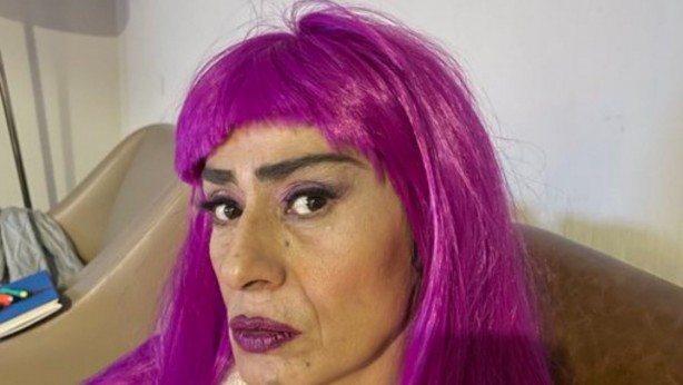 Foto - Yıldız Tilbe yine yaptı yapacağını! Görenler, "Ne gerek vardı şimdi buna" dedi