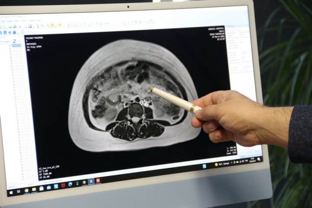 Foto - Yıllardır 'göbeğim var' sanıyordu! Doktora gidince acı gerçeği öğrendi