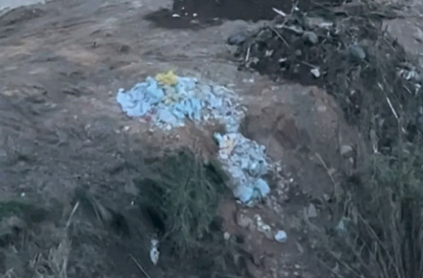 Foto - Yine CHP’li belediye, yine ağaç katliamı! Taşıyoruz dediler katlettiler