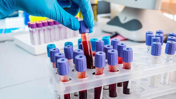 Foto - Yiyeceklerdeki büyük tehlike! Kanser yapıyor