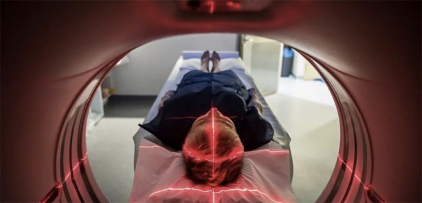 Foto - Yok artık diyeceksiniz! Yapay zeka kanser hastalarının kalan ömrünü hesapladı