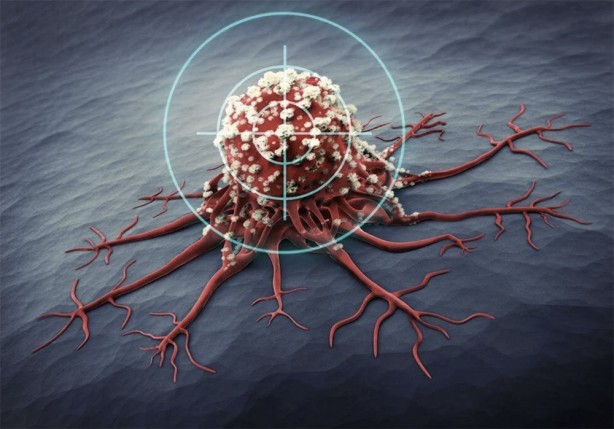 Foto - Yok artık diyeceksiniz! Yapay zeka kanser hastalarının kalan ömrünü hesapladı