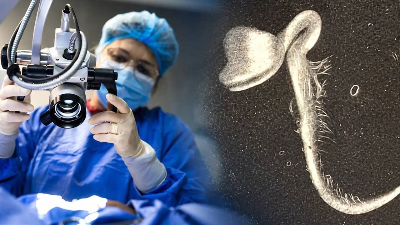 Foto - Yok böyle tıp vakası: Gözünden çıkan şey doktorları bile şoke etti