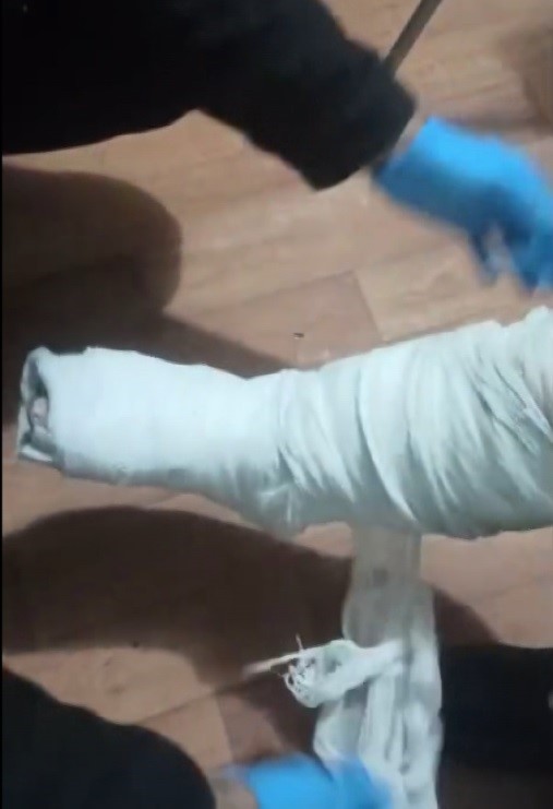 Yolcunun ayağına sarılı alçından bakın ne çıktı! Ait olduğu yere uğurlandı!