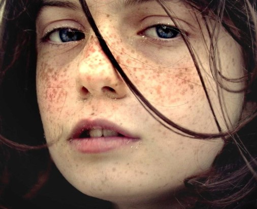 Foto - Yüzdeki çillerin sebebi nedir? Çillerden nasıl kurtuluruz?