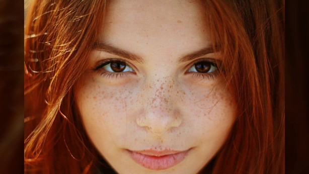 Yüzdeki çillerin sebebi nedir? Çillerden nasıl kurtuluruz?