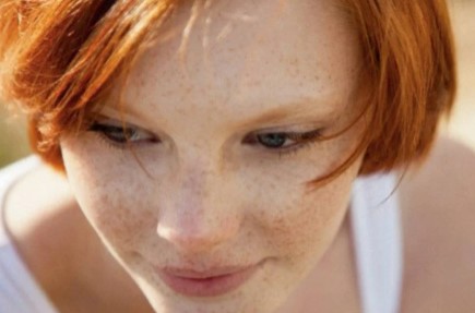 Foto - Yüzdeki çillerin sebebi nedir? Çillerden nasıl kurtuluruz?