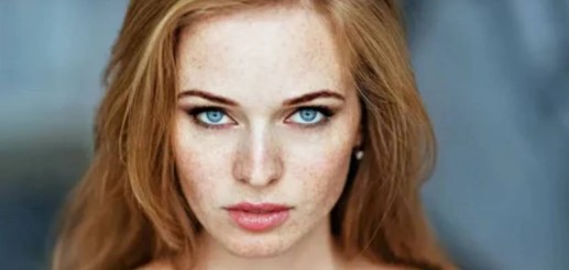 Foto - Yüzdeki çillerin sebebi nedir? Çillerden nasıl kurtuluruz?