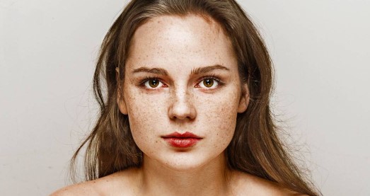 Foto - Yüzdeki çillerin sebebi nedir? Çillerden nasıl kurtuluruz?