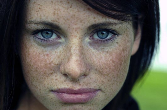 Foto - Yüzdeki çillerin sebebi nedir? Çillerden nasıl kurtuluruz?