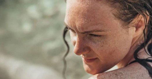 Foto - Yüzdeki çillerin sebebi nedir? Çillerden nasıl kurtuluruz?