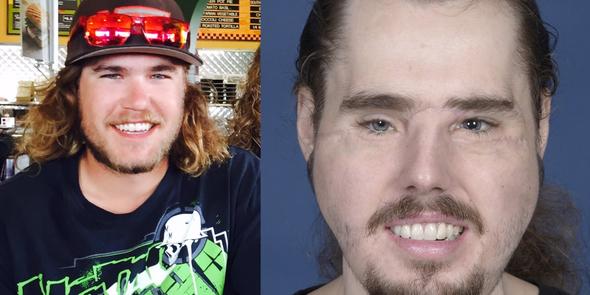 Foto - Yüzü parçalanan adamın inanılmaz değişimi