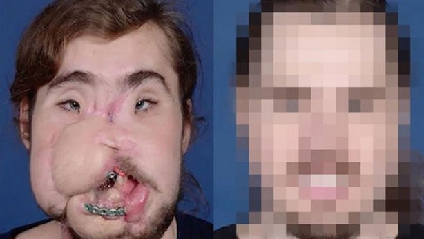 Yüzü parçalanan vatandaşın inanılmaz değişimi