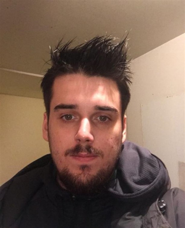 Foto - Yüzü parçalanan vatandaşın inanılmaz değişimi