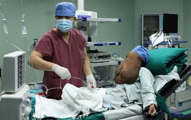 Foto - Yüzünde 15 kiloluk tümörle yaşıyor