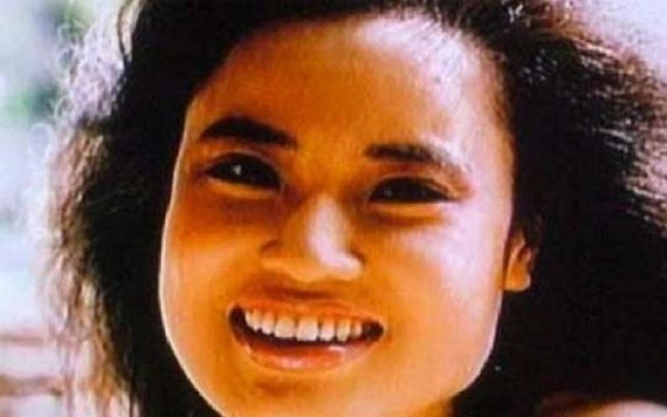 Yüzüne yemeklik yağ enjekte etti