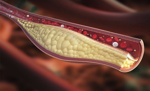 Foto - Zayıflamak istiyorsanız, günde 1 su bardağı...