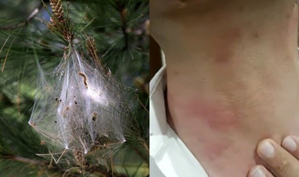 Zehir saçıyor! Sakın temas etmeyin