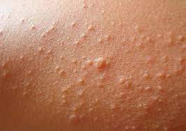 Foto - Zerdeçal çayının tiryakisi olmanızı sağlayacak 16 faydası dikkat! Duyunca şaşıracaksınız: İlgi çekti