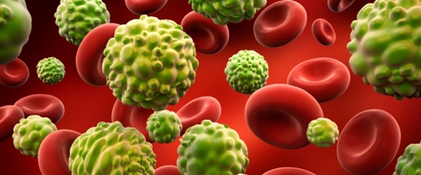 Foto - Zerdeçal sütünü hayatınızdan eksik etmeyin!