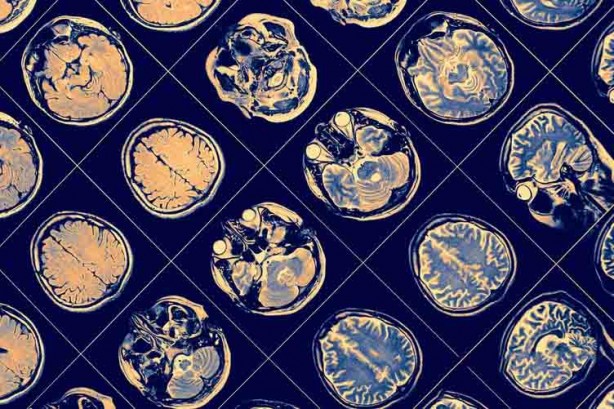 Foto - Zeytin yapraklarını atıyorduk meğerse muhteşem bir ilaçmış: Daha önce hiç görülmemiş inanılmaz faydaları mevcut