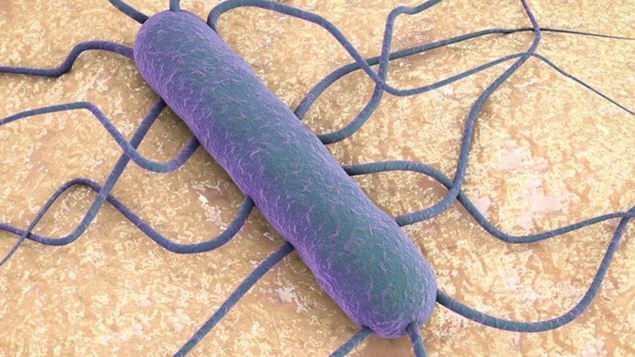 Zincir market raflarındaki o markada 'Listeria' uyarısı! Uzmanı ölümcül tehlike deyip uyarı yaptı, biliyor muydunuz?