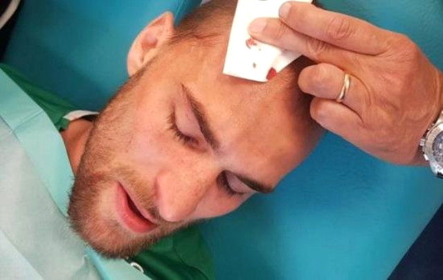 Taraftarın Saldırdığı Bas Dost'un Psikolojisi Bozuldu