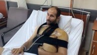 Çöpte bulduğu tabancayı kurcalarken az daha ölüyordu