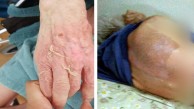 Huzurevinde kaynar su ile banyo sonrası ölümle 6 taksitle 21 bin lira ceza