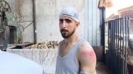 Trafikte yavaş gidiyor diye burnunu kırıp kafasını yardılar