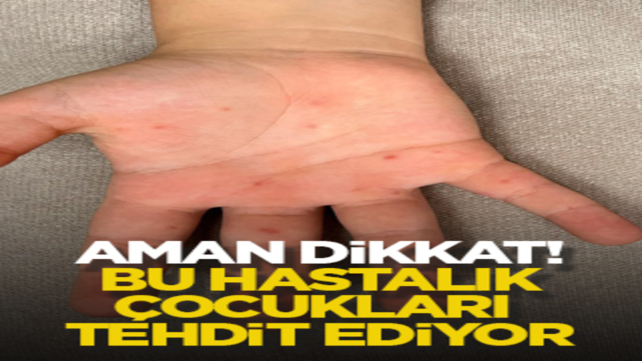 Aman dikkat! Bu hastalık çocukları tehdit ediyor
