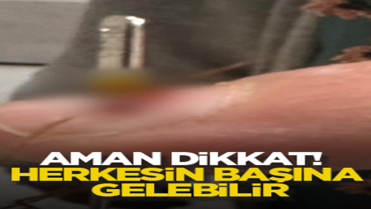 Aman dikkat! Herkesin başına gelebilir