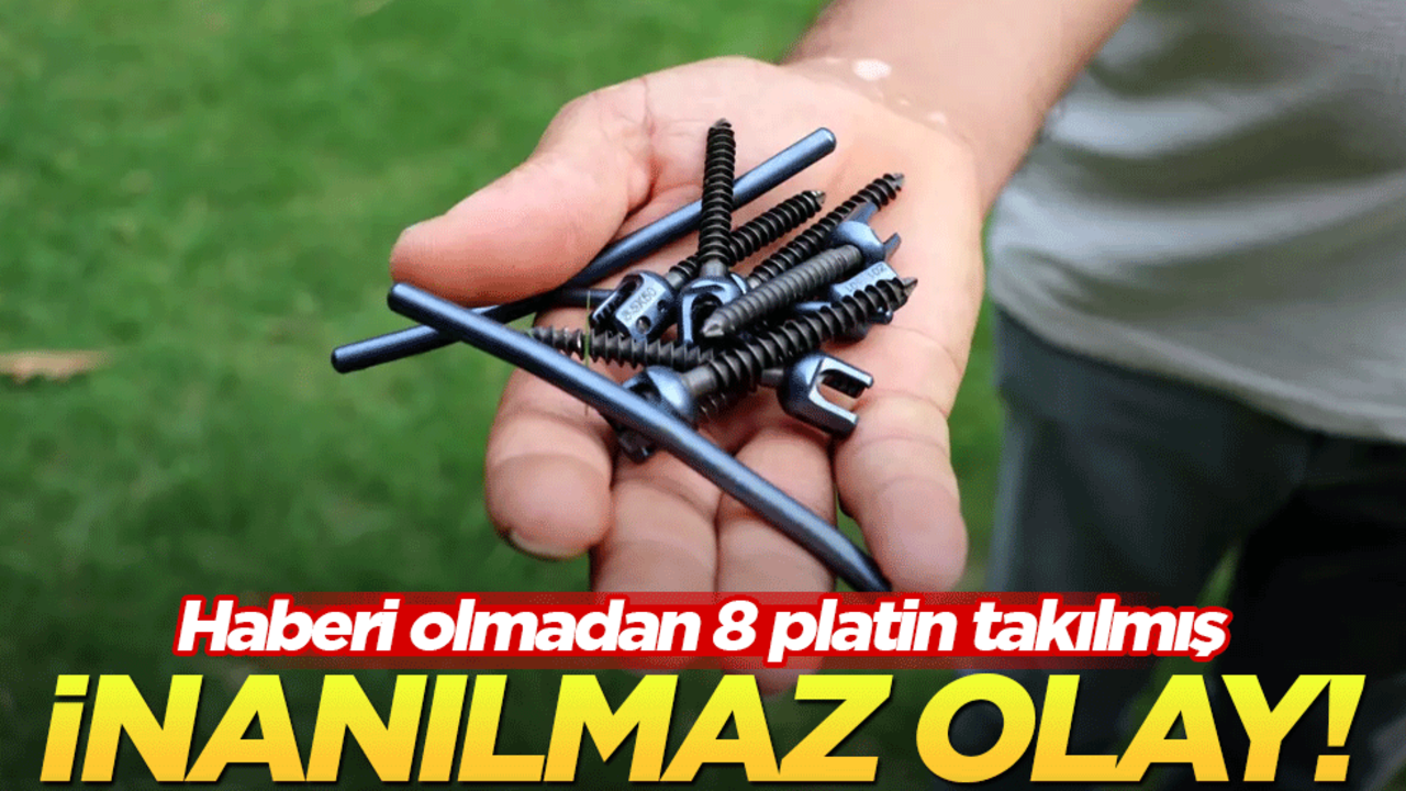 Antalya'da inanılmaz Olay! Haberi olmadan vücuduna 8 platin takıldı