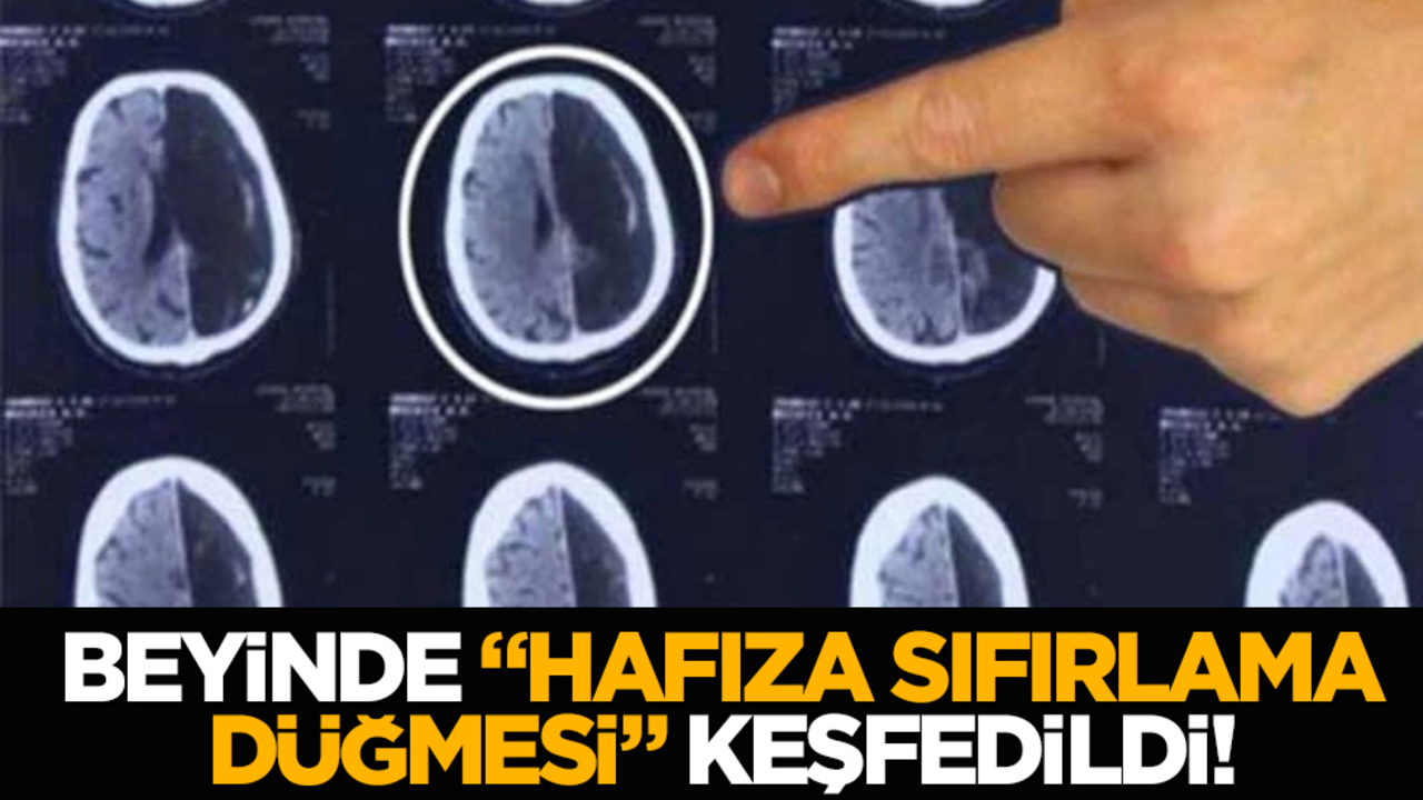 Beyinde "hafıza sıfırlama düğmesi" keşfedildi!