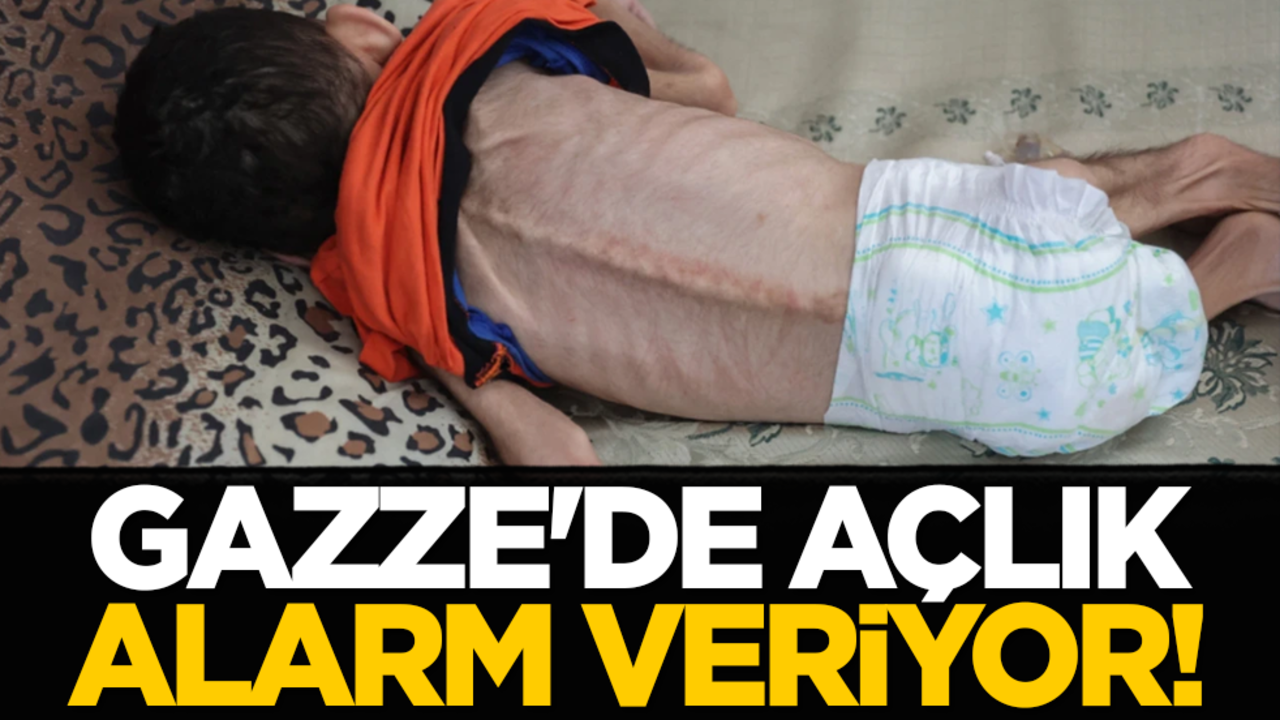 Gazze'de açlık alarm veriyor!